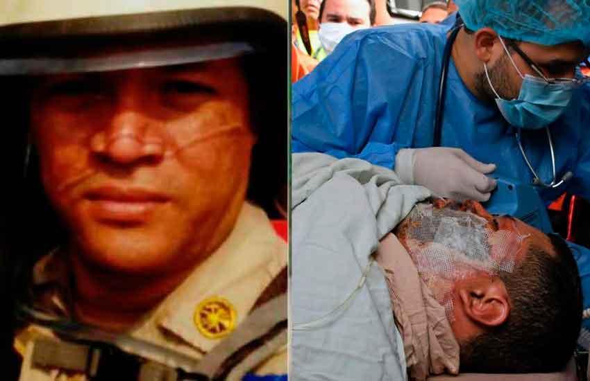 Fallece uno de los bomberos trasladados a México